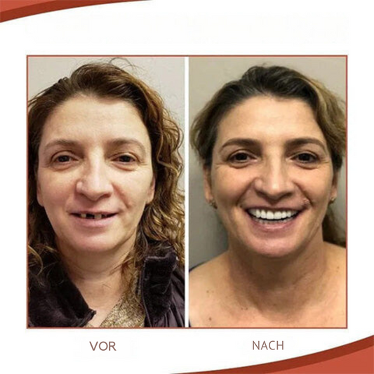 Dopiv | Biocompatible Prosthesis Set for Pain-Free Fit and Natural Smile