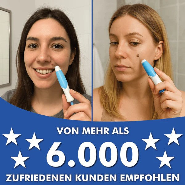 Dopiv Wart-Free PRO - The Professional Wart Remover